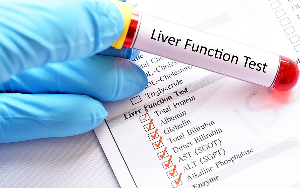 Liver Function Test Lft Best Pathology Lab And Diagnostic Centre