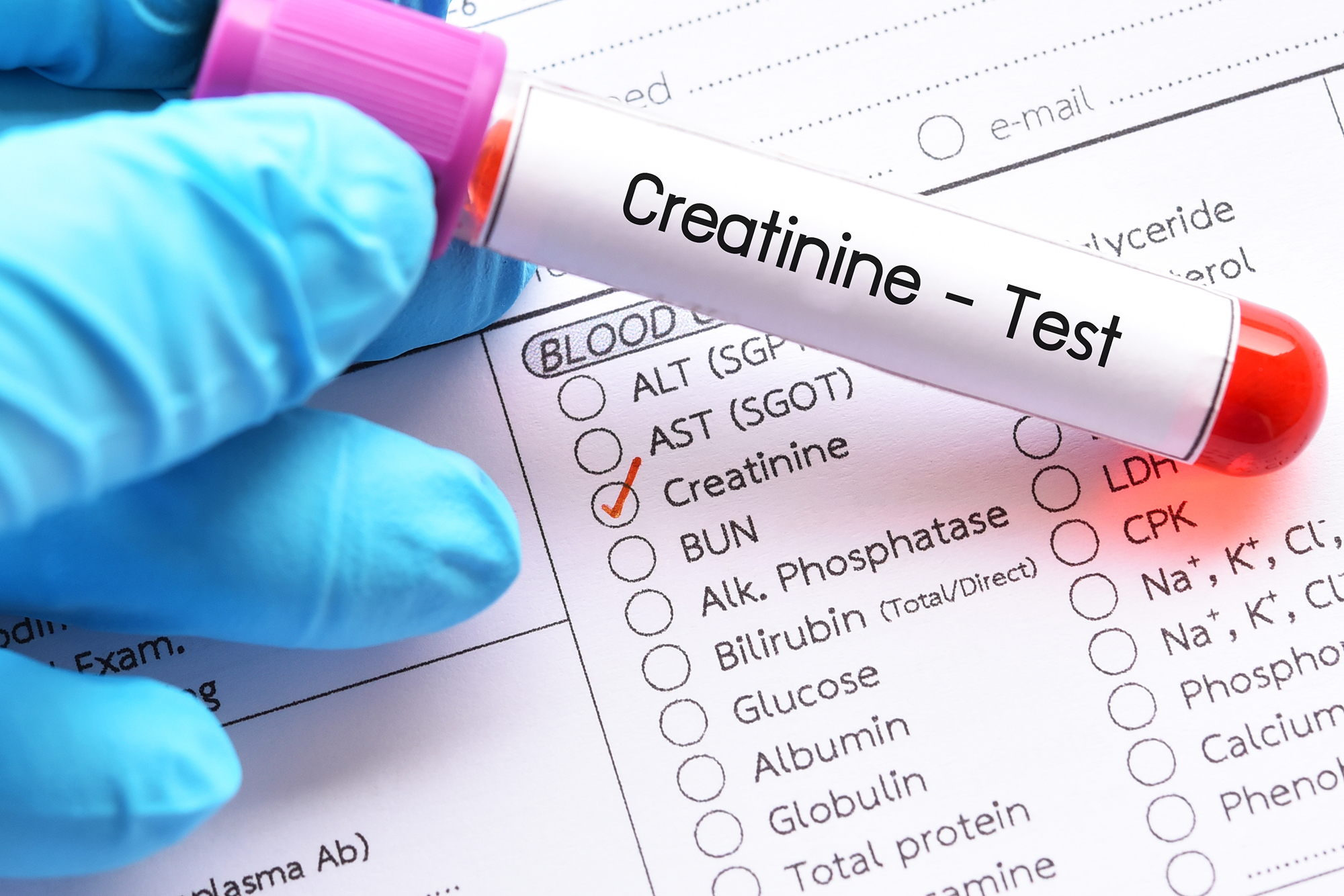 Creatinine-Test-High-Low-Normal-Levels-1