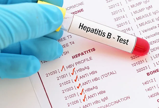 hepatitis-b-test
