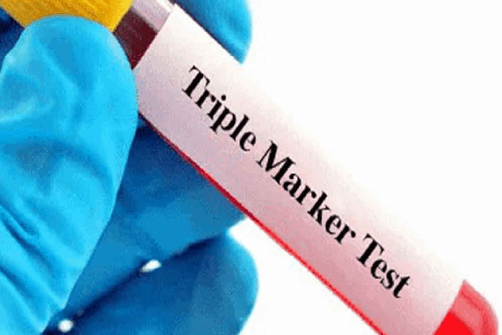 triple-marker-test